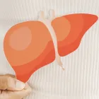 ウイルス性肝炎